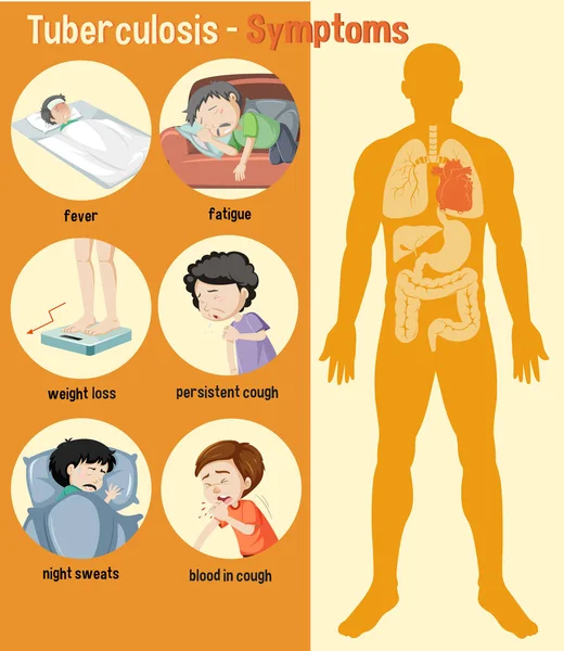 Tuberculosis Síntomas Información Ilustración Infográfica — Archivo Imágenes Vectoriales