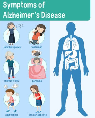 Alzheimer Hastalığının Semptomları Infographic Illustration