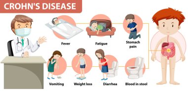 Crohn 'un Hastalık İllüstrasyonunun Tıbbi Bilgileri