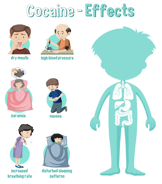 Gezondheidseffecten Van Cocaïne Infografische Illustratie — Stockvector