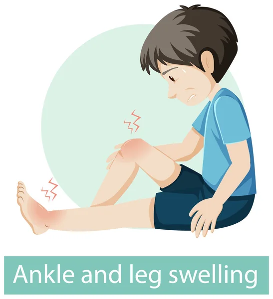 Cartoon Character Ankle Leg Swelling Symptoms Illustration — Stock Vector