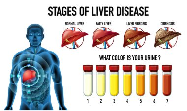 Karaciğer hastalığı çiziminin aşamaları