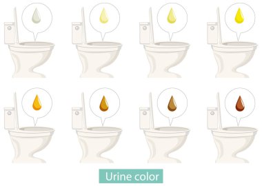 Set of different urine color illustration clipart