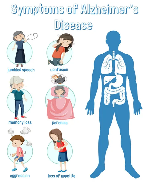 Alzheimer Hastalığının Semptomları Infographic Illustration — Stok Vektör