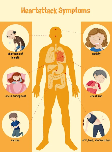 Hjärtattack Symtom Information Infografisk Illustration — Stock vektor