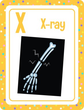 X-ray çizimi için X harfli alfabe bellek kartı