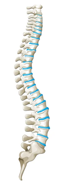 Diagrama de columna que muestra dolor de espalda — Vector de stock