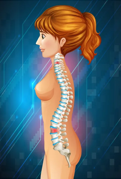 허리 통증을 표시 하는 척추 다이어그램 — 스톡 벡터