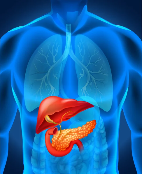 Pankreas kanseri insan vücudunda — Stok Vektör
