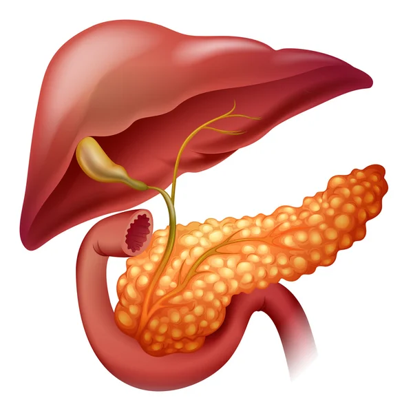 Diagrama del cáncer de páncreas en detalle Ilustración de stock