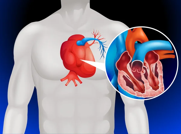 Heart disease diagram in detail — Stock Vector