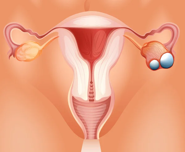 卵巣がん図を詳しく — ストックベクタ