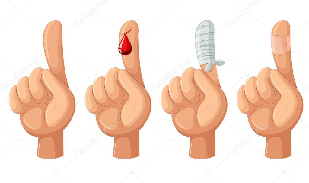 Finger with cut and bandages