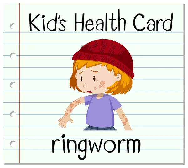 Gezondheidskaart met ringworm — Stockvector