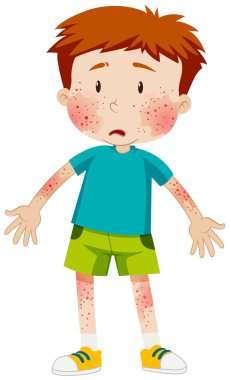 Bulaşıcı hastalığı olan üzgün çocuk