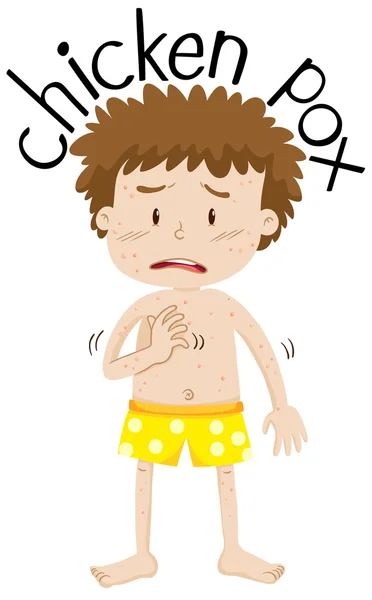 Boy having chicken pox — Stock Vector