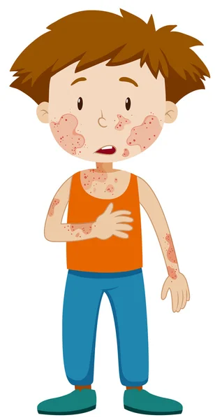 Мальчик с инфекционными заболеваниями — стоковый вектор