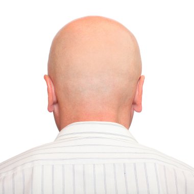 Saçsız kafa alanı ile