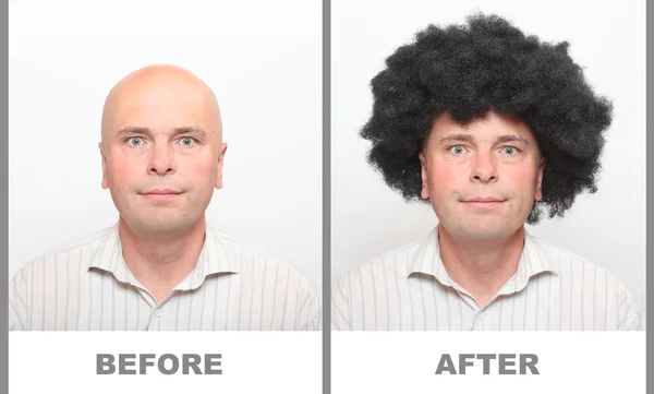 Homem e homem sem cabelo com cabelo bonito — Fotografia de Stock