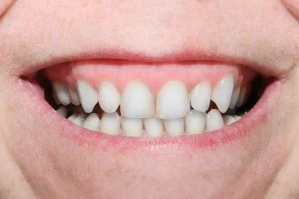 Close up a big mouth showing a  teeth. — Stock Photo, Image