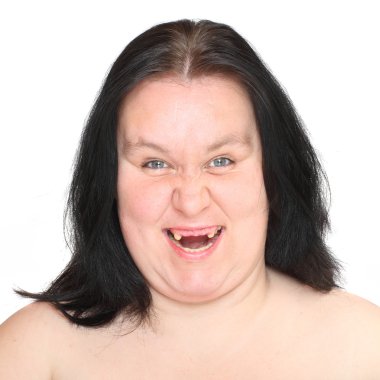ugly woman with missing teeth. clipart