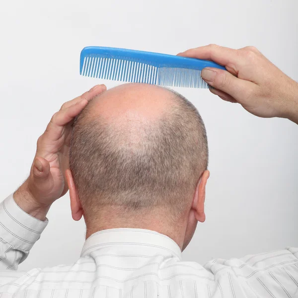 Haarloze mens met kam. — Stockfoto