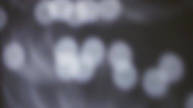 Disko ışıkları bir duvara yansıyor