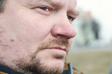 Kısa kırmızı sakallı bir adam mesafeye bakar, yakından.