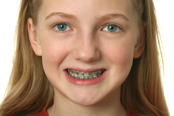 Menina com aparelho dental em seus dentes — Fotografia de Stock