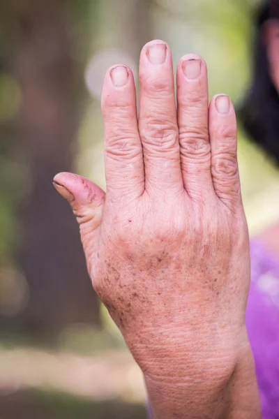 Задня рука старенької азіатки — стокове фото