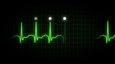 EKG monitör ekran