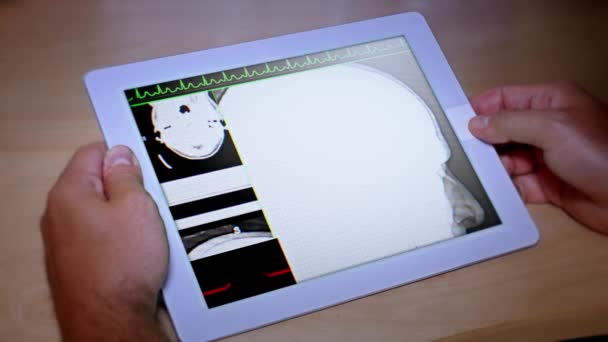 4К доктор изучает МРТ на планшетном ПК — стоковое видео