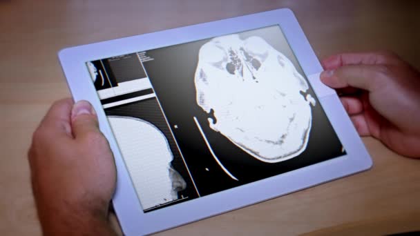 4K medico esamina la risonanza magnetica su un PC tablet — Video Stock