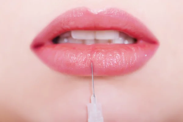 Uroda medyczne wstrzykiwań idealne usta — Zdjęcie stockowe