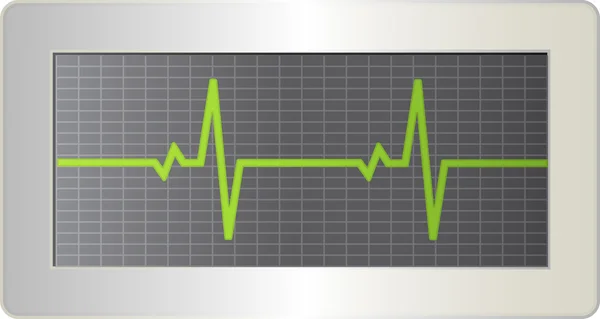 Elektrocardiogram signaal op het scherm. — Stockvector