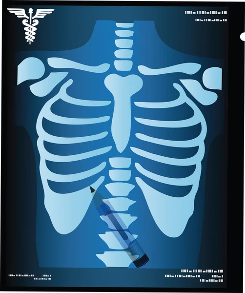 De pictogrammen van de medische behandeling — Stockvector