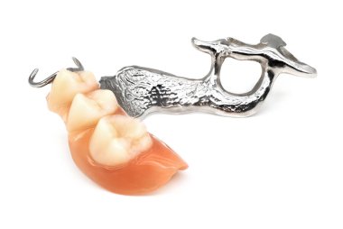 Çıkarılabilir Kısmi Takma Diş, beyaz arka planda diş protezlerinin kapatılması