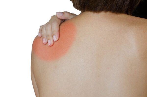 Acute pain in a woman shoulder.