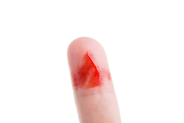 Human Finger Dirty Streaks Blood Cut Consequence Damage Skin Open — Stock Photo, Image