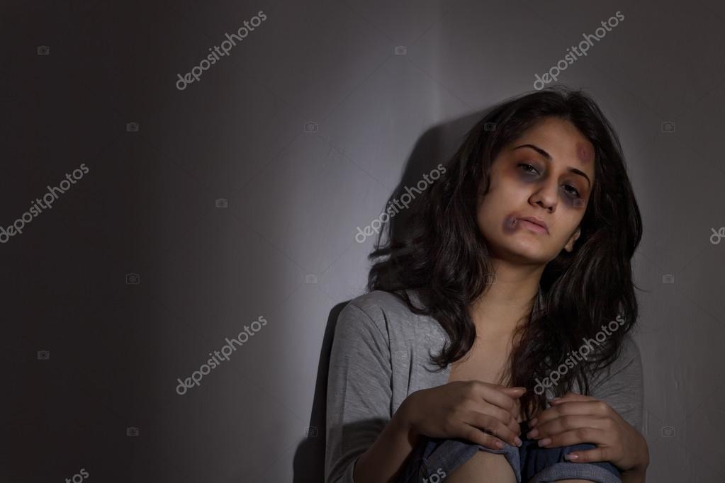https://st2.depositphotos.com/1778008/7299/i/950/depositphotos_72997631-stock-photo-physically-abused-woman.jpg