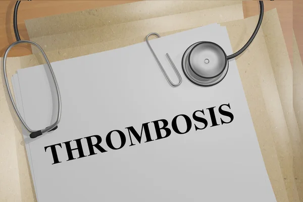 Concepto medicial de trombosis — Foto de Stock