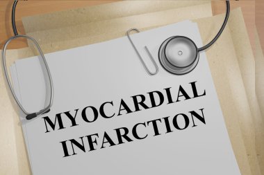 Miyokard İnfarktüsü tıp kavramı