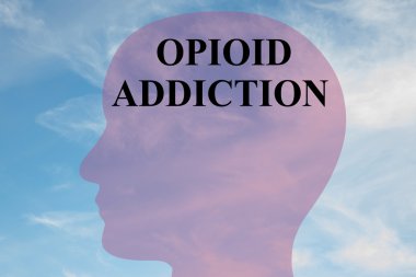 Opioid bağımlılığı kavramı