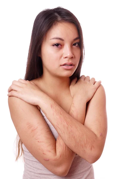 Junge Frau mit selbst zugefügten Schnittwunden weint — Stockfoto