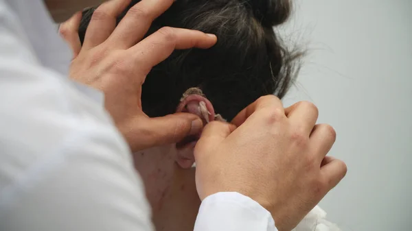 Врач Снимает Бинты Проверить Девушку После Пластической Операции Уха — стоковое фото