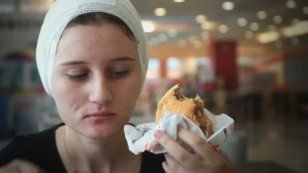 Meisje Met Hoofdletsel Chirurgie Verband Het Hoofd Die Een Hamburger — Stockfoto