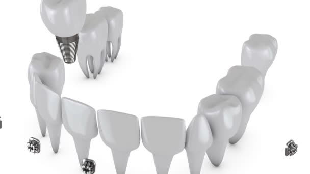 Soportes dentales de animación — Vídeo de stock