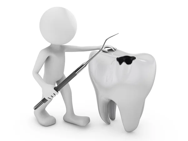 Tooth decay — Stock Photo, Image