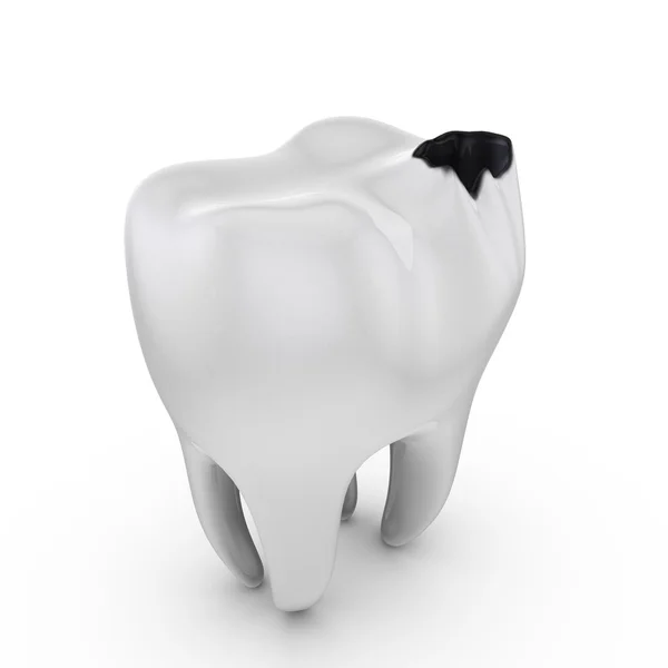 Decadência dentária — Fotografia de Stock