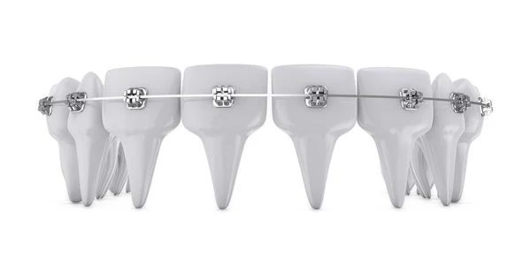 Staffe dentali — Foto Stock